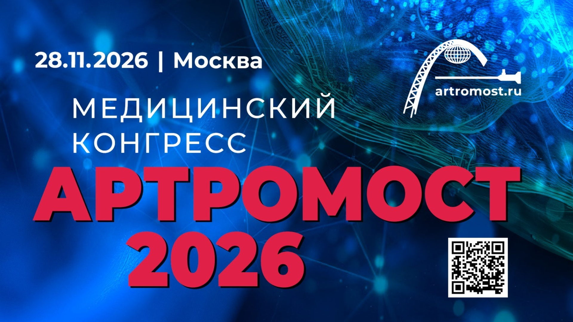 Артромост 2026